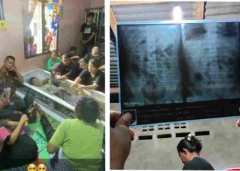 Letusan Tembakan Saat Kejar Siswa yang Kendarai Sepeda Motor Kambam 5 Membuat Korban Lompat dan Terjatuh Diduga Sempat Ditabrak Oknum Polisi