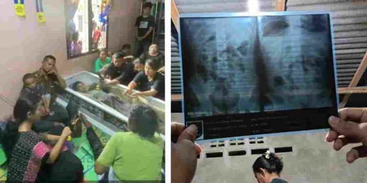 Letusan Tembakan Saat Kejar Siswa yang Kendarai Sepeda Motor Kambam 5 Membuat Korban Lompat dan Terjatuh Diduga Sempat Ditabrak Oknum Polisi