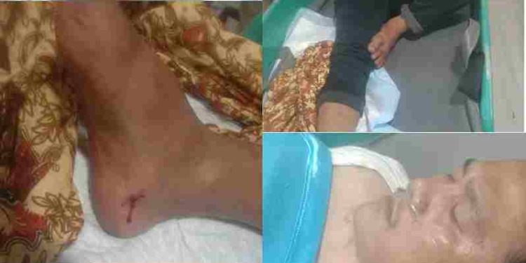 Polres Simalungun Amankan Pelaku Penembakan Massal di Perumahan Rorinata, 5 Warga Terluka